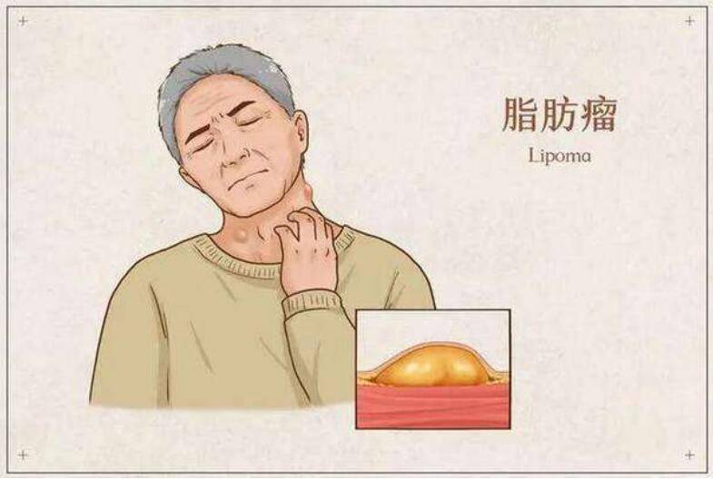 medias-uploads/ty-202312/f2f8994ff04c66d6b9ae8948f7dc567b.jpg 76.jpg