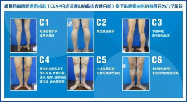 955_f21f226b6f1567cd9494ca3713b1432f.jpg 955_f21f226b6f1567cd9494ca3713b1432f.jpg